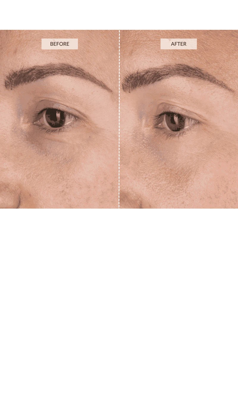 CurrentBody Skin | LED Eye Perfector | Fully Wearable Anti-Ageing Device for Around the Eyes | Wrinkle Reduction to Target Crows Feet and Brow Furrows
