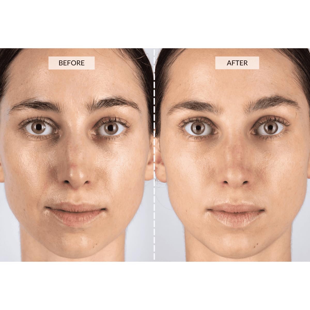 CurrentBody Skin LED Light Therapy Face Mask | Red Light Therapy Treatment Device | Anti-Aging Face Mask for Wrinkle Reduction